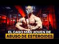 Tiene 19: Le han dado 10 años de vida | DOCUMENTAL