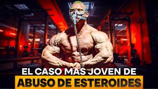 Tiene 19. Le han dado 10 años de vida | DOCUMENTAL