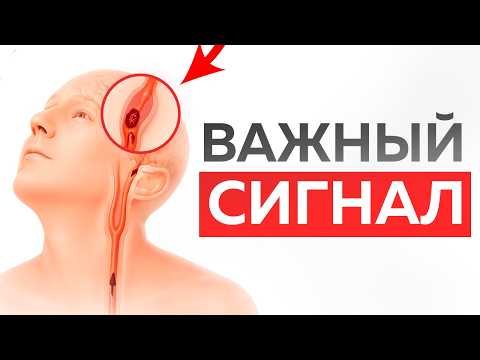 Что НА САМОМ ДЕЛЕ вызывает головные боли? 1 точка, которая снимает головные боли и мигрень