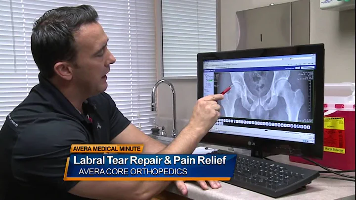 Labral tear repair and pain relief -  Medical Minute
