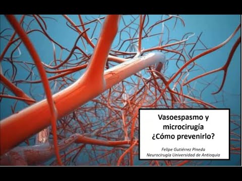 Video: ¿Hipertensión inducida en el vasoespasmo cerebral?