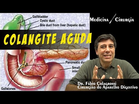 COLANGITE AGUDA