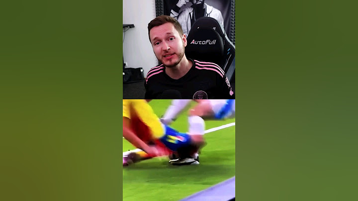 Die heftige Messi Verletzung 😳 #shorts