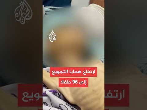 استشهاد طفلتين جراء التجويع وسوء التغذية ونقص العلاج