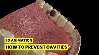 How to Prevent Cavities: 7 Proven Tips Every American Should Know