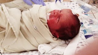 Families with NICU babies react to Carilion's changing guidelines