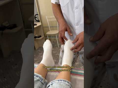 Поперечное плоскостопие Самодиагностика #сервистела