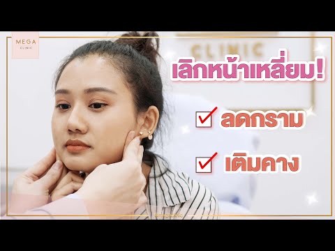 [รีวิว] เลิกหน้าเหลี่ยม ต้องลดกราม+เติมคาง ที่เมกะคลินิก | Mega Clinic