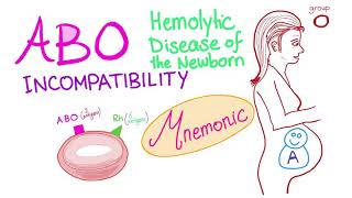 Abo Incompatibility Mnemonic - Hemolytic Anemia - Normocytic Anemia