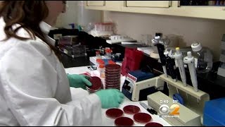 Dr. Max Gomez: 'CDiff' Bacteria Could Make People Healthy