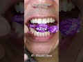 The Most Satisfying Chocolate and Candy ASMR Compilation 🍫🍬 #DoctorTristanPeh #Chocolate #Candy