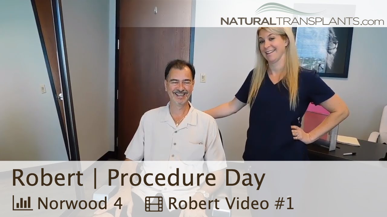 fue hair transplant month by month Hair Growth Patient Travels 4,750 Miles from Hawaii for Best Treatment for Hair Growth (Robert)