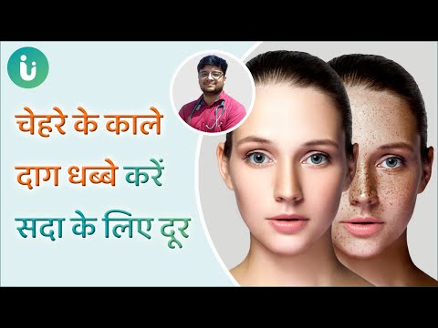 वीडियो: आप चपरासी पर काले धब्बे से कैसे छुटकारा पा सकते हैं?