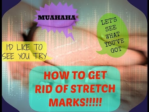 HOW STRETCH MARKS FORM AND HOW TO GET RID OF THEM: DML STYLE