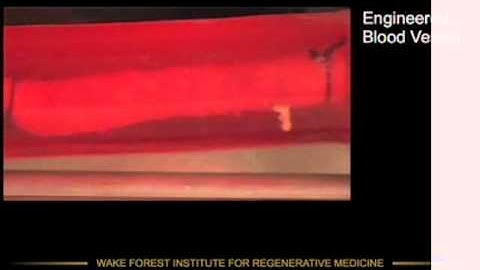 Tissue Engineering: Bioreactors 2 - blood vessels