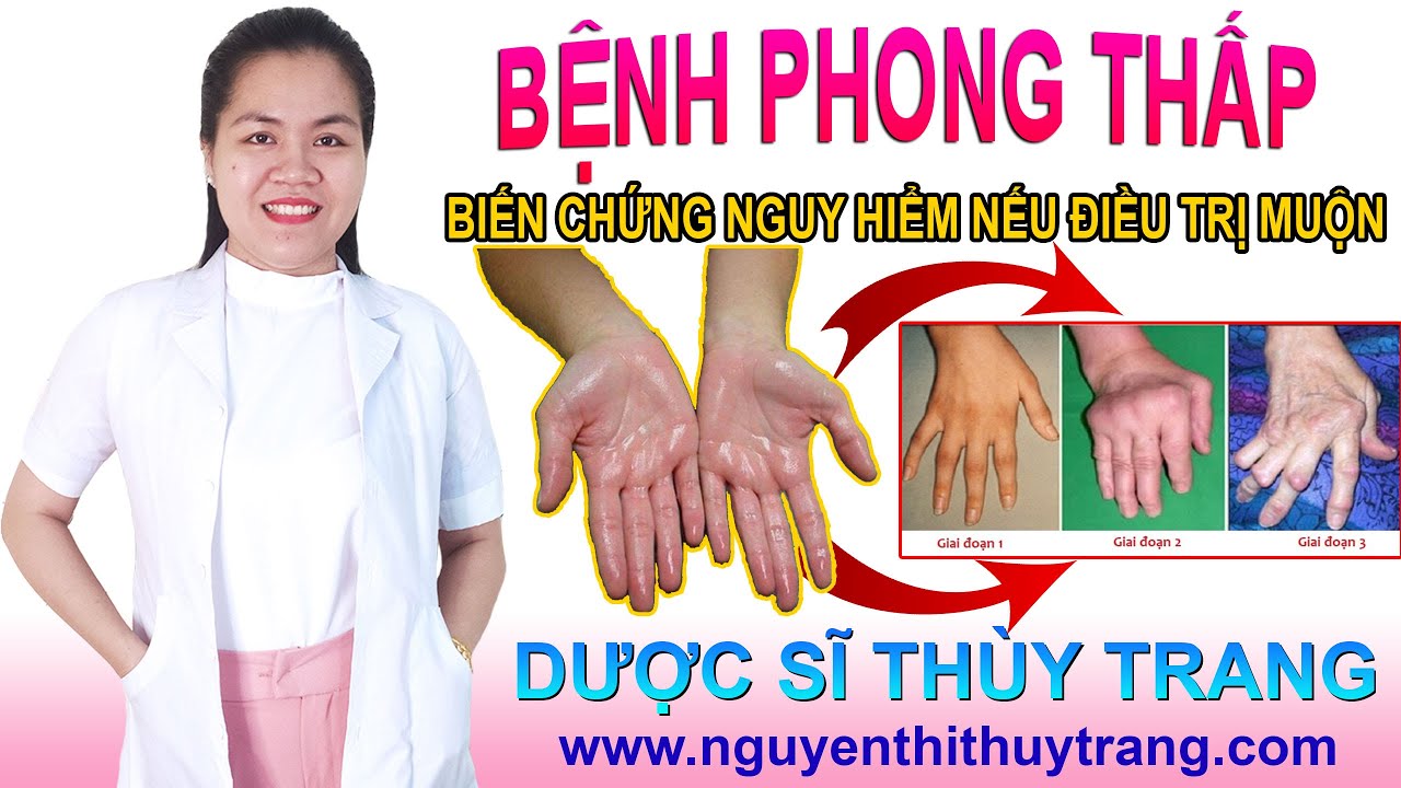 Bệnh phong thấp là gì? Cách chữa trị hiệu quả tốt nhất | Bao quát những nội dung liên quan bệnh phong thấp và cách chữa chuẩn nhất