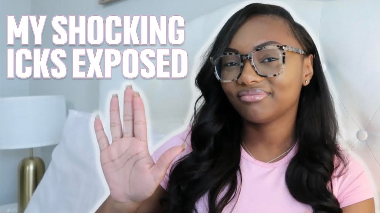 MY SHOCKING ICKS EXPOSED 🤯 Are you guilty of these too? YouTube