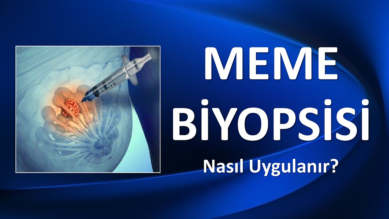 MEME BİYOPSİSİ Nasıl Uygulanır?