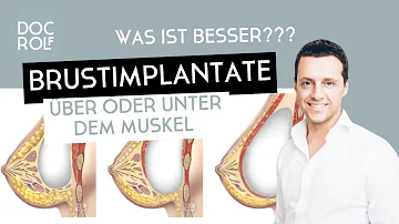 Wie fühlt man sich mit Brustimplantaten?