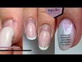 CRACKED Nails, Lifting & SUPER Dry Cuticle + Skin 😨 Can They Be Fixed?