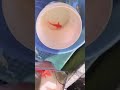 BẮT PHI TẦN ĐỎ TẠI AO
