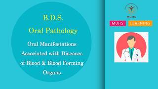 Oral Manifestations - Diseases of Blood & Blood Forming Organs | Oral Pathology | BDS | 00808 screenshot 4