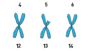 Whole Exome Sequencing, Part 2: Analyzing the Data