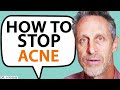 The BIG CAUSE Of Acne &amp; How To Get Rid of It QUICKLY | Dr. Mark Hyman