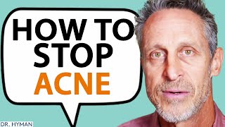 The BIG CAUSE Of Acne & How To Get Rid of It QUICKLY | Dr. Mark Hyman
