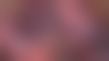 Right S2 lung segmentectomy by VATS