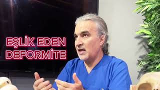 Güvercin Göğüs Korsesi Tedavisinde Neden %100 Başarılı?