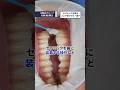 セラミック治療はどこで受けても一緒？#歯医者 #セラミック #審美歯科