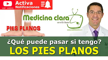 ¿Se puede tener pie plano con CMT?