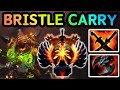 🔥 BRISTLEBACK CARRY — FULL DPS, FULL TANK, FULL IMPACT 😂 | DOTA 2 GAMEPLAY 🔥