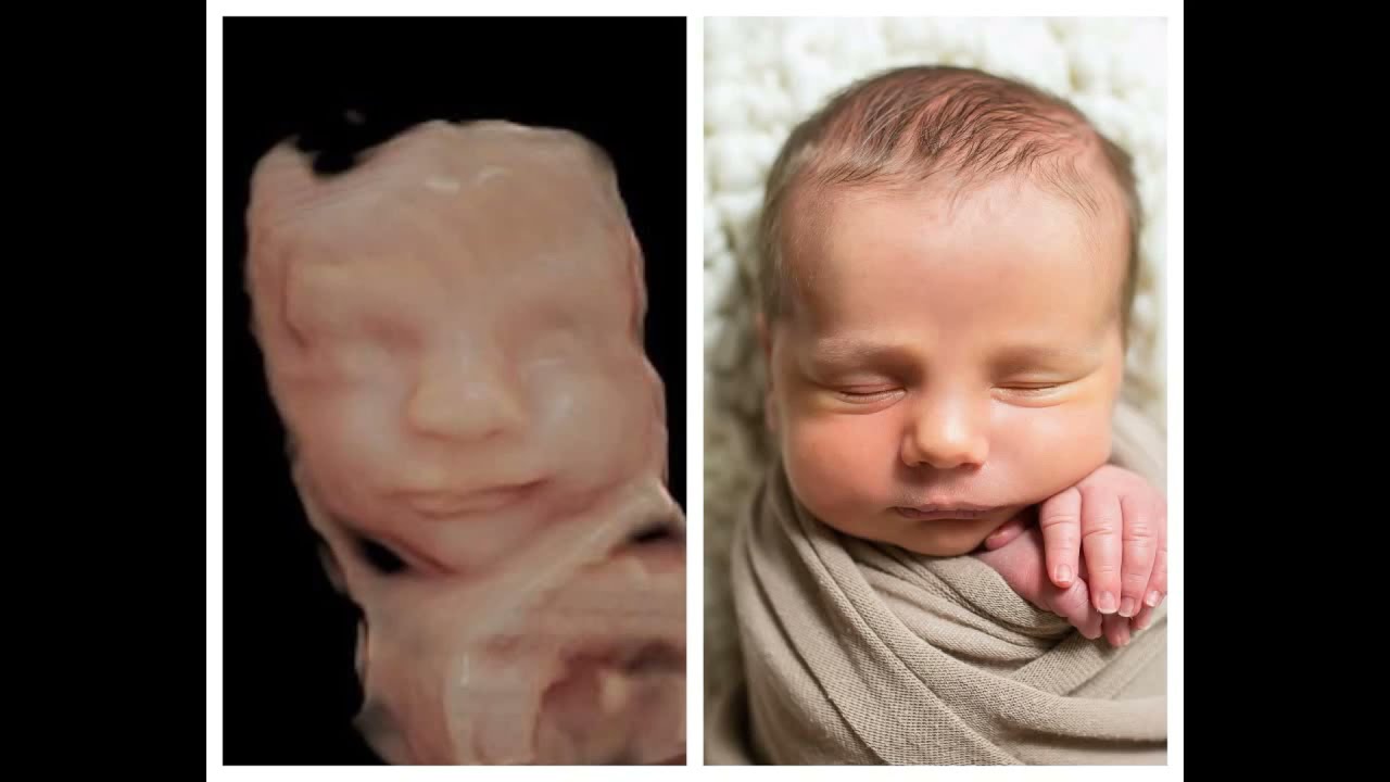 Chison Sonobook 9 Ultrasound Machine with 4D Virtual HD (Featuring The Nest OKC Ultrasound)