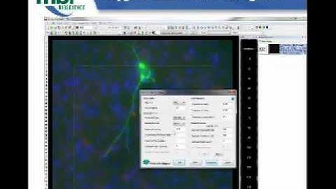 Webinar: New Features in Version 10 Neurolucida and Stereo Investigator