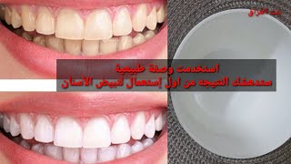 افضل طريقة لتبيض الأسنان/ teeth whitening at home