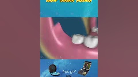 [3D] NHỔ RĂNG KHÔN || Nha Khoa Quốc Tế Athena