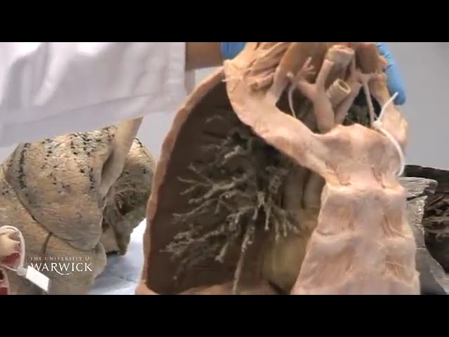 University of Warwick | The Lungs