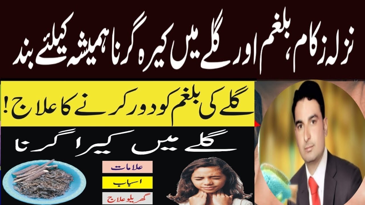post nasal drip/treatment/Galy ma resha any ki kia waja ha is ka ilag by Dr Nasrullah