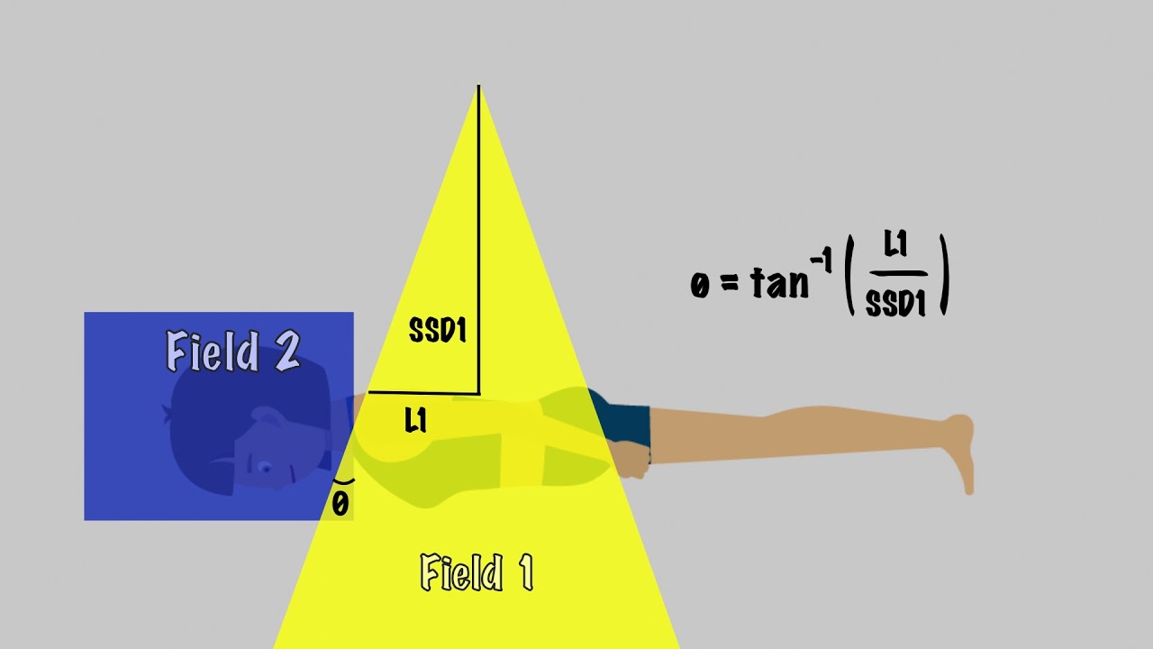 HiPhy #4- Photon Field Matching (CSI)