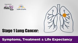 Stage 1 Lung Cancer: Symptoms, Treatment & Life Expectancy | Episode 6