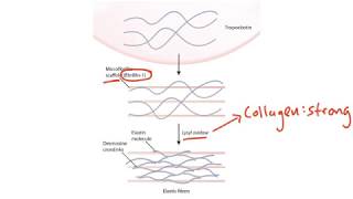 USMLE Step 1 Connective Tissue