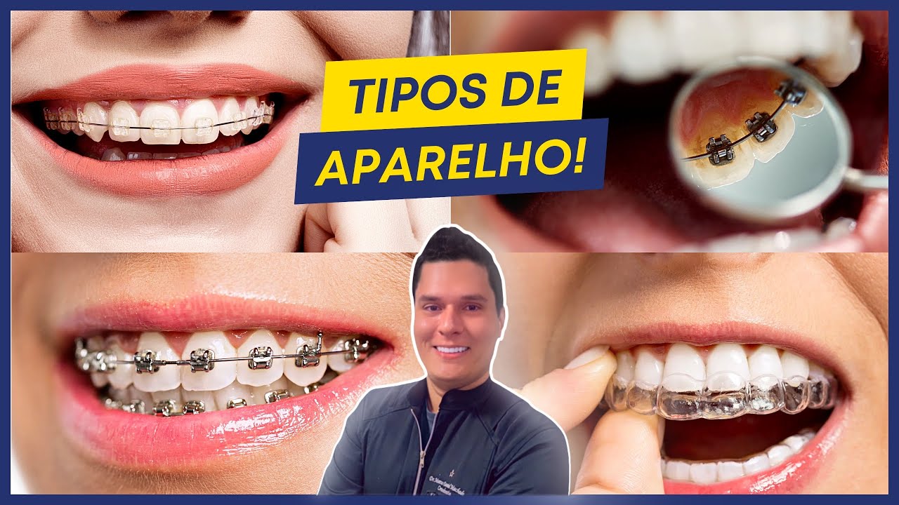 PARA QUE SERVE CADA TIPO DE APARELHO?