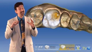 CEREC Software Shape Tools