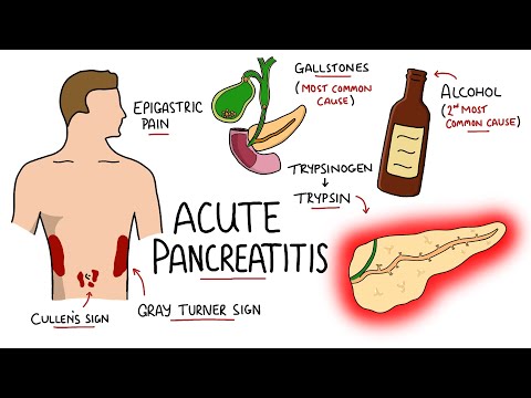 Video: Misterul pancreatitei pelvine
