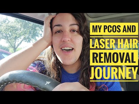 My PCOS and Laser Hair Removal Journey