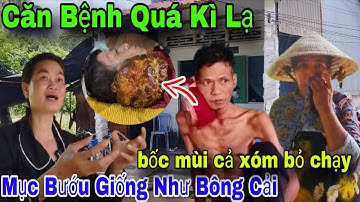Khẩn cấp người đàn ông 44 tuổi bị bệnh lạ mục bướu như bông cải bốc mùi cả xóm bỏ chạy 
