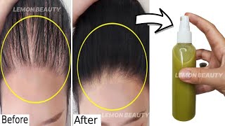 Just Apply This Oil To Your Scalp & Grow Extremely Long Hair & Stop Extreme Hair Fall