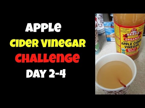 day-2--4:-bragg-apple-cider-vinegar-challenge-+-intermittent-fasting-|-70-lb-weight-loss-journey